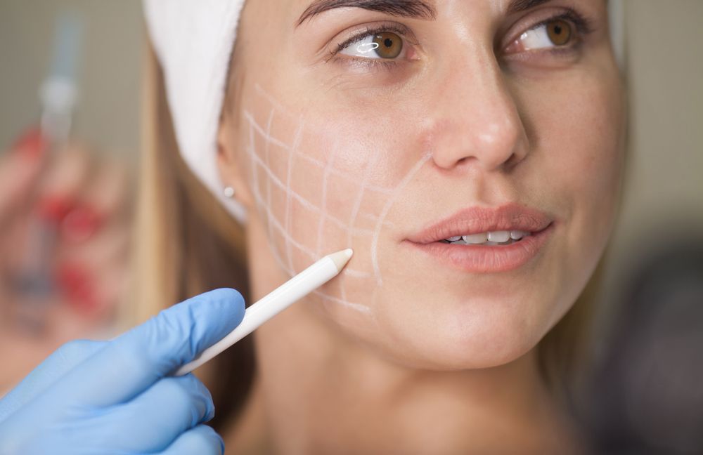 Cytocare Revitacare, mésothérapie visage